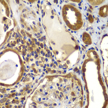 Immunohistochemistry of paraffin-embedded human kidney using NME2/NM23B antibody  at dilution of 1:100 