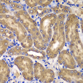 Immunohistochemistry of paraffin-embedded mouse kidney using NME2/NM23B antibody  at dilution of 1:100 
