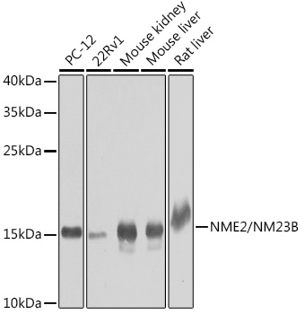 Western blot analysis of extracts of various cell lines, using NME2/NM23B antibody  at 1:1000 dilution