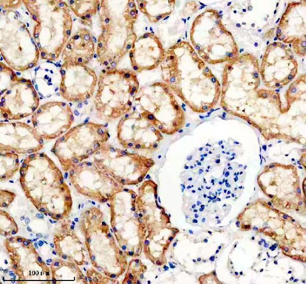 IHC analysis of SLC4A4 using anti-SLC4A4 antibody (A01763-1)