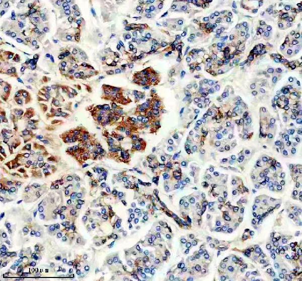 IHC analysis of SLC4A4 using anti-SLC4A4 antibody (A01763-1)