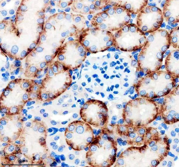 a01763 1 slc4a4 primary antibodies ihc testing 3