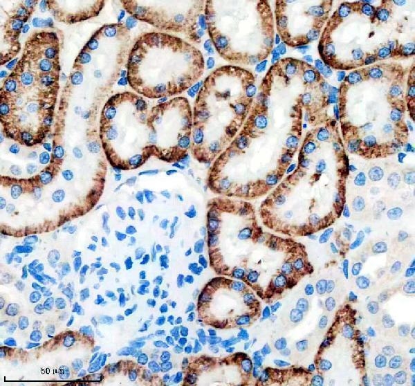 a01763 1 slc4a4 primary antibodies ihc testing 4