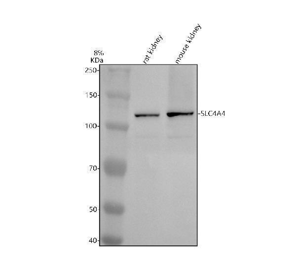 Western blot analysis of SLC4A4 using anti-SLC4A4 antibody (A01763-1)