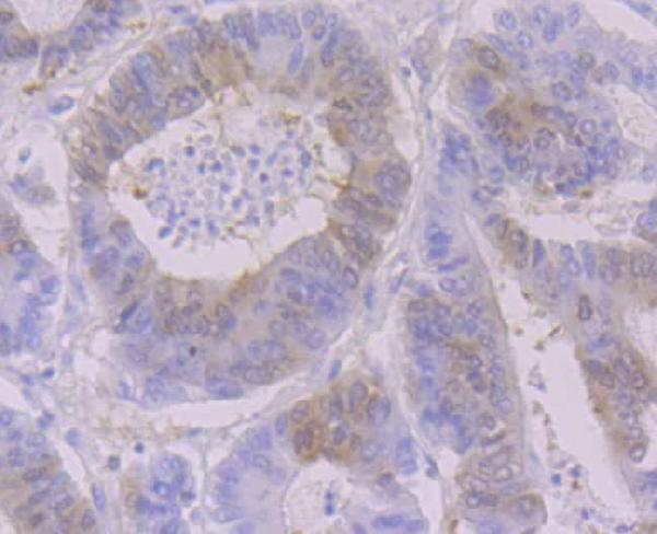 a01764 1 rrm1 primary antiboties ihc testing 2