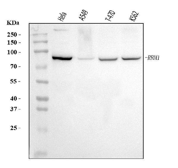  Western blot analysis of RRM1 using anti-RRM1 antibody (A01764-2)