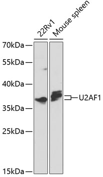 a01765 u2af1 primary antiboties wb testing 1