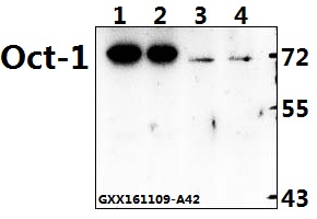 Western blot (WB) analysis of Oct-1 (L68) polyclonal antibody at 1:500 dilution
Lane1:MCF-7 whole cell lysate(40ug)
Lane2:SGC7901 whole cell lysate(40ug)
Lane3:L02 whole cell lysate(40ug)