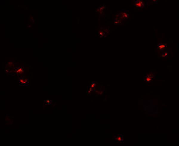 Immunofluorescence of PROM1 in Jurkat cells with PROM1 antibody at 20 μg/mL