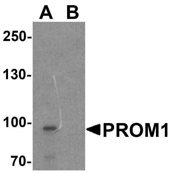 Western blot analysis of PROM1 in Jurkat cell lysate with PROM1 antibody at 1 μg/ml in (A) the absence and (B) the presence of blocking peptide