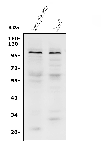  Western blot analysis of PROM1 using anti-PROM1 antibody (A01767-3)