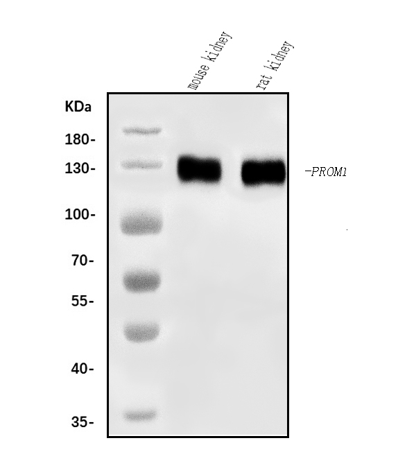  Western blot analysis of CD133/Prom1 using anti-CD133/Prom1 antibody (A01767-4)