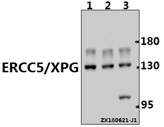 Western blot (WB) analysis of ERCC5/XPG (E160) pAb at 1:1000 dilution
Lane1:PC3 whole cell lysate(40ug)
Lane2:SGC7901 whole cell lysate(20ug)
Lane3:HCT116 whole cell lysate(20ug)