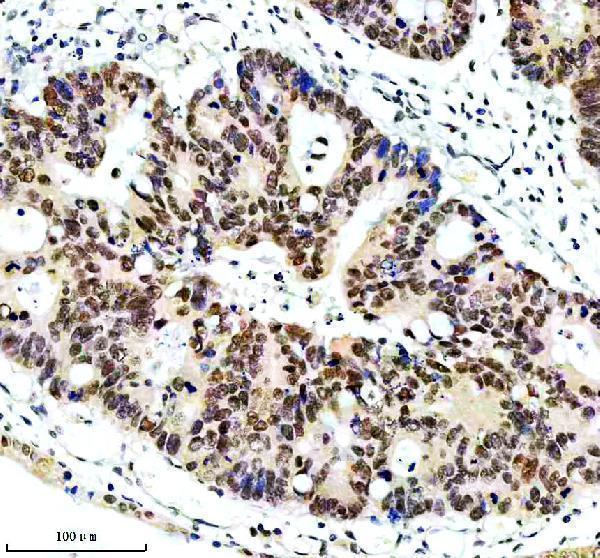IHC analysis of ERCC5 using anti-ERCC5 antibody (A01770-2)