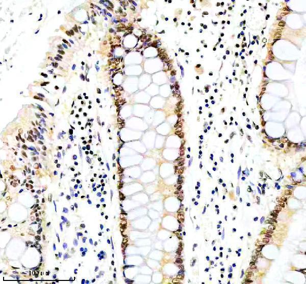 IHC analysis of ERCC5 using anti-ERCC5 antibody (A01770-2)