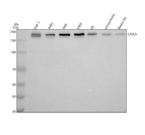Western blot analysis of ERCC5 using anti-ERCC5 antibody (A01770-2)