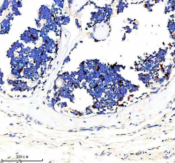  IHC analysis of DOCK8 using anti-DOCK8 antibody (A01771-1)