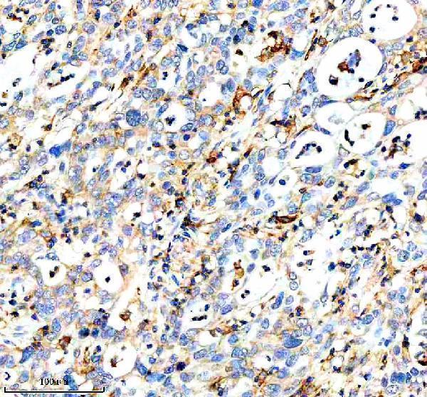  IHC analysis of DOCK8 using anti-DOCK8 antibody (A01771-1)