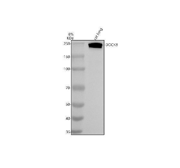  Western blot analysis of DOCK8 using anti-DOCK8 antibody (A01771-1)