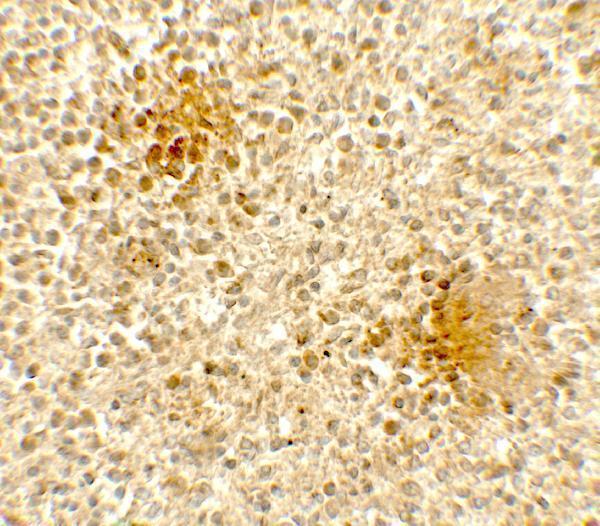 Immunohistochemistry of DOCK8 in human spleen tissue with DOCK8 antibody at 5 μg/mL