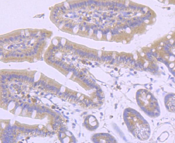 a01772 1 axin2 primary antiboties ihc testing 2_1