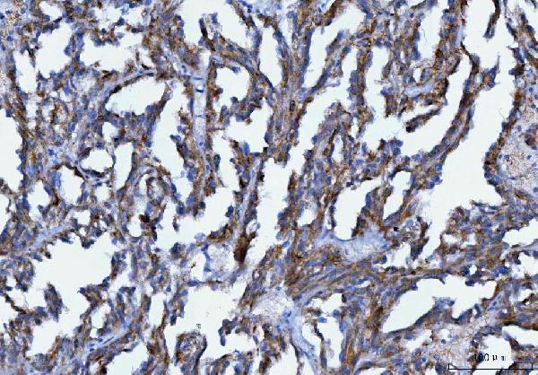  IHC analysis of Axin 2/AXIN2 using anti-Axin 2/AXIN2 antibody (A01772-2)