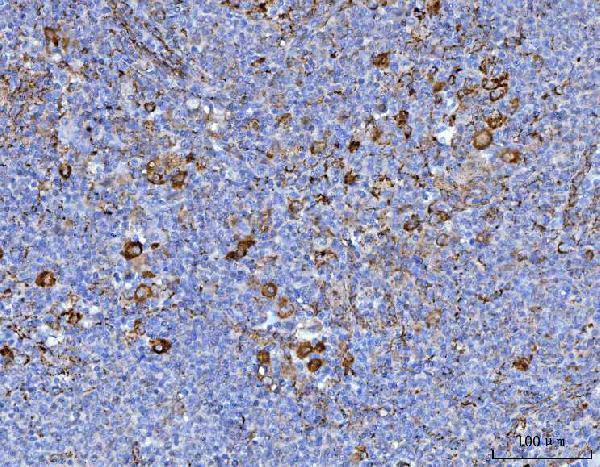  IHC analysis of Axin 2/AXIN2 using anti-Axin 2/AXIN2 antibody (A01772-2)