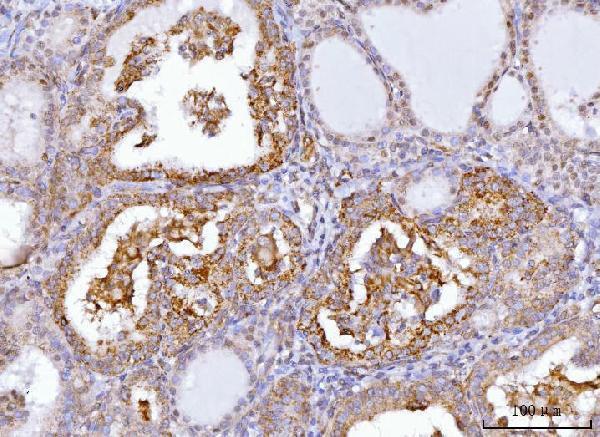 a01772 2 axin2 primary antibodies ihc testing 4