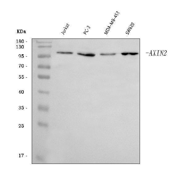  Western blot analysis of Axin 2/AXIN2 using anti-Axin 2/AXIN2 antibody (A01772-2)