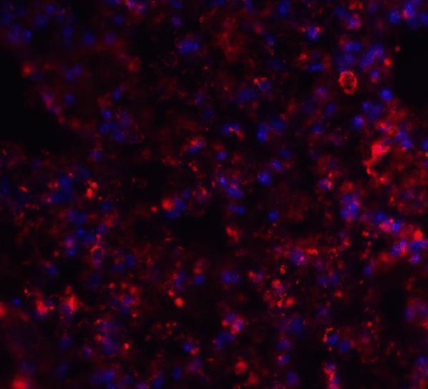 a01772 axin2 primary antibodies if testing 5