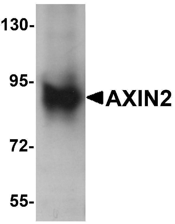 a01772 axin2 primary antibodies wb testing 1