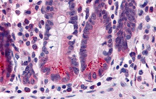 a01773 birc6 primary antibodies ihc testing 1