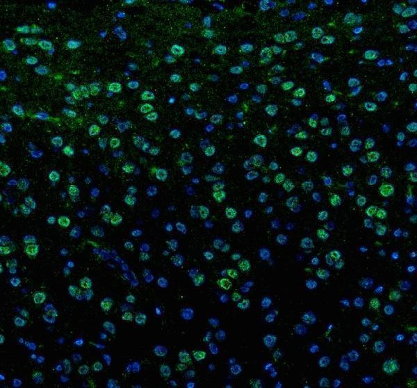 a01774 1 mid1 primary antibodies if testing 1