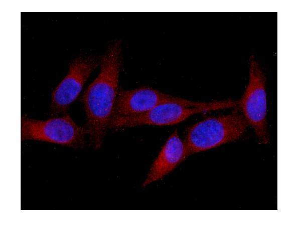 a01774 1 mid1 primary antibodies if testing 4