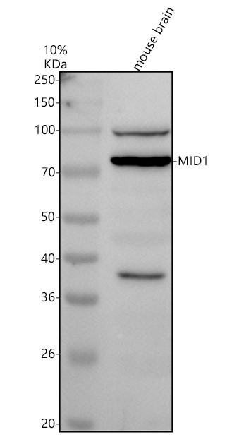a01774 1 mid1 primary antibodies wb testing 2