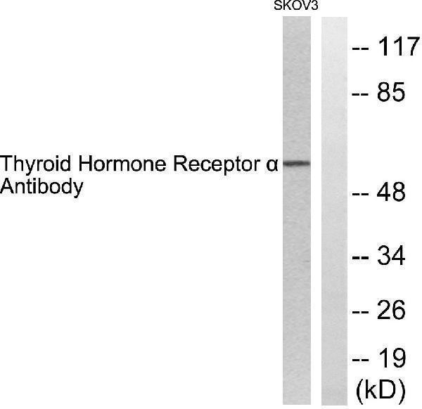 Western blot analysis of lysates from SKOV3 cells, using Thyroid Hormone Receptor alpha Antibody