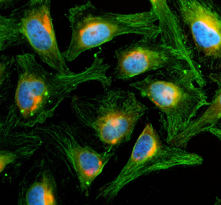 a01775 3 thra primary antibodies if testing 1
