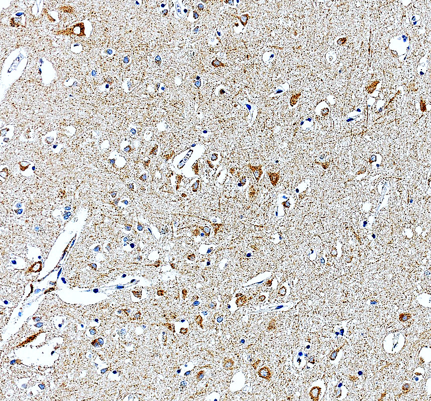 a01775 3 thra primary antibodies ihc testing 1