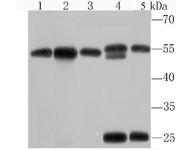 Western blot analysis of KPNA2 on different cell lysates using anti-KPNA2 antibody at 1/1,000 dilution