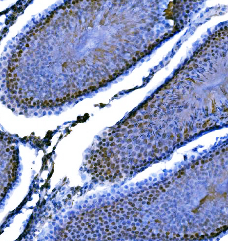  IHC analysis of KPNA2 using anti-KPNA2 antibody (A01776-3)
