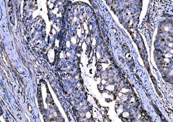  IHC analysis of KPNA2 using anti-KPNA2 antibody (A01776-3)