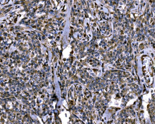 a01776 3 kpna2 primary antibodies ihc testing 4