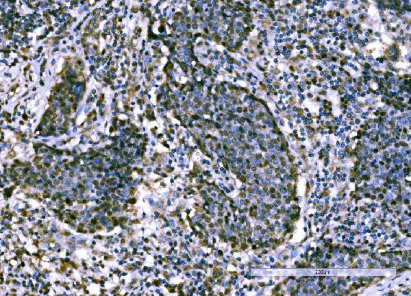 a01776 3 kpna2 primary antibodies ihc testing 5