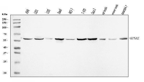  Western blot analysis of KPNA2 using anti-KPNA2 antibody (A01776-3)