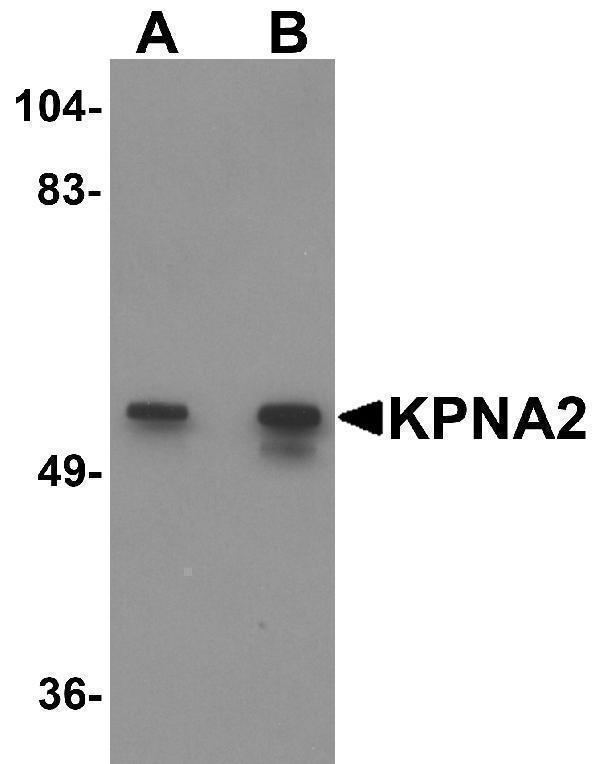 a01776 kpna2 primary antibodies wb testing 1