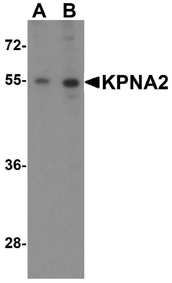 a01776 kpna2 primary antibodies wb testing 4