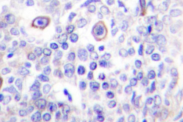 a01777 cd83 primary antiboties ihc testing 2