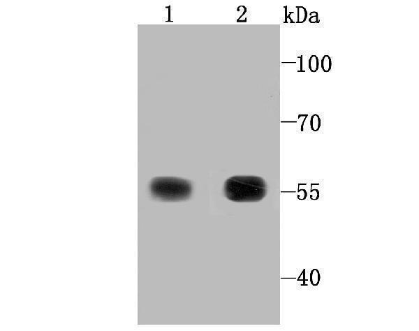 Western blot analysis of TXNRD1 on Hela (1) and human liver tissue lysate (2) using anti-TXNRD1 antibody at 1/1,000 dilution