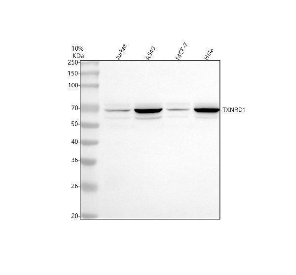  Western blot analysis of TXNRD1 using anti-TXNRD1 antibody (A01778-3)