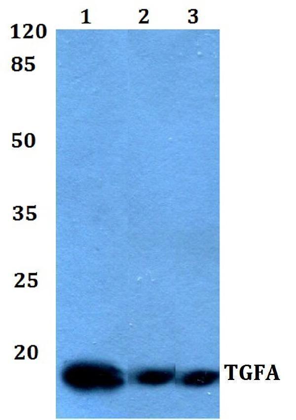 Western blot (WB) analysis of TGFα polyclonal antibody at 1:500 dilution
Lane1:THP-1 whole cell lysate
Lane2:Mouse brain tissue lysate
Lane3:Rat brain tissue lysate